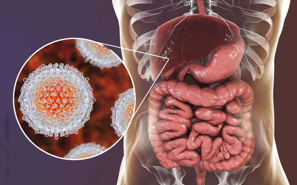 Hepatitis C virus infection