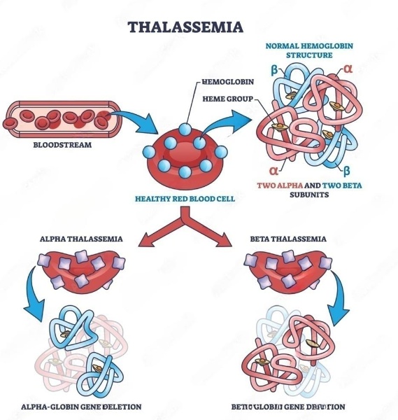 Alpha and beta Thalassemia