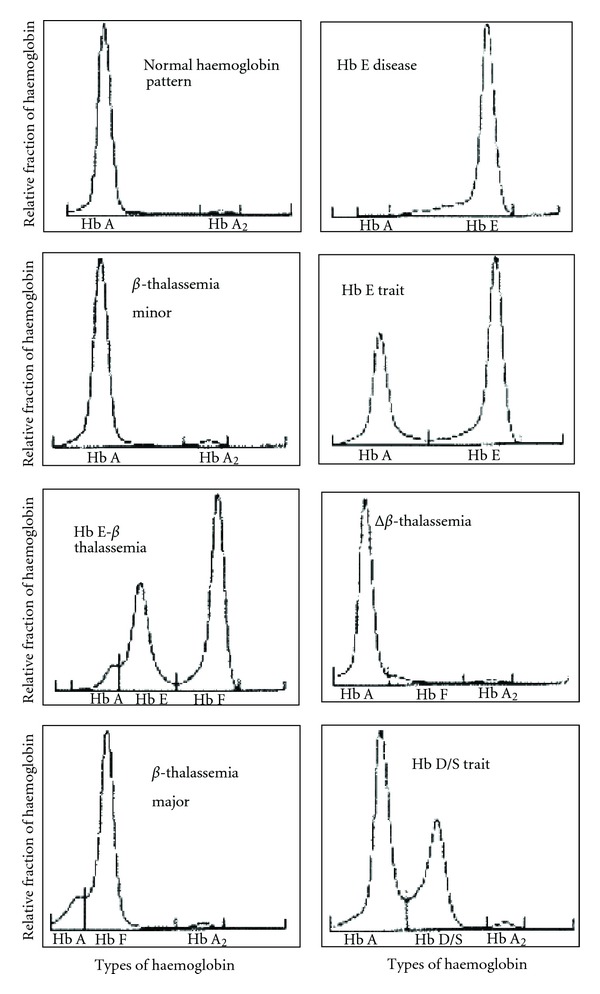 Pattern of β-Thalassemia and Other Haemoglobinopathies (Uddin et al., 2012)